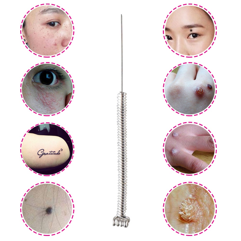 100 & 200Pcs Plasma Pen Naald  - Industrial Laser For Cleaning recensie en prijs